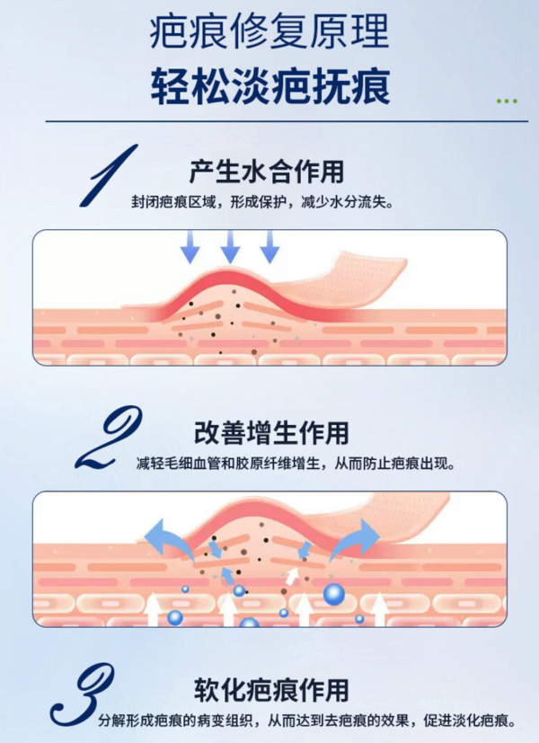 ReKeyMed 美國(guó)進(jìn)口醫(yī)用硅酮凝膠 1支裝